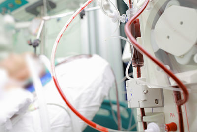 Patient in a hospital bed hooked up to IV&apos;s